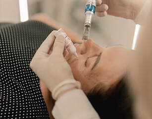 Microneedling