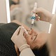 Microneedling